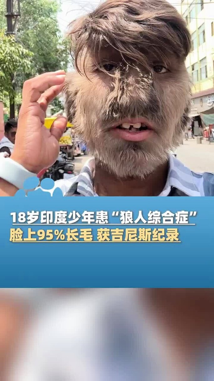 贵妃毛片的相关介绍